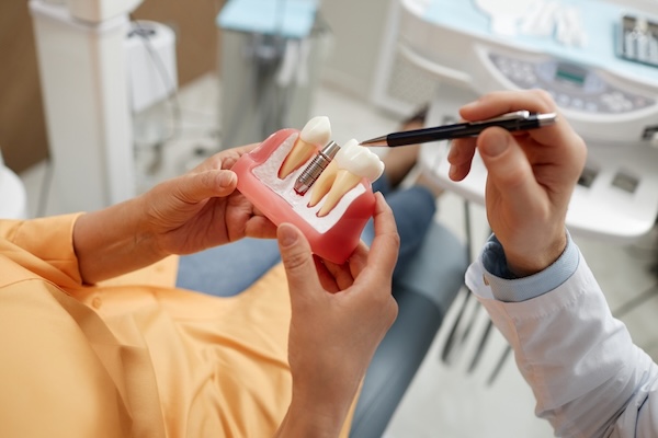Dental Implants Near Marietta: What to Expect & Recovery Tips