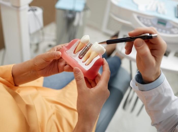 Dental Implants Near Marietta: What to Expect & Recovery Tips